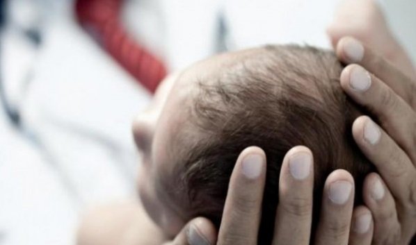 Baru 3 Bulan Dilahirkan, Bayi di Cianjur Ini Mengidap Penyakit Langka