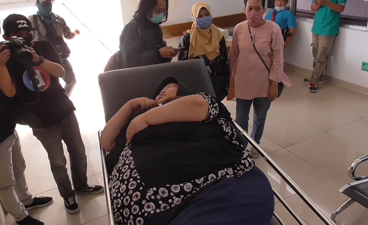 Heni, Wanita Asal Sumedang Alami Obesitas dengan Berat Badan 145 Kg