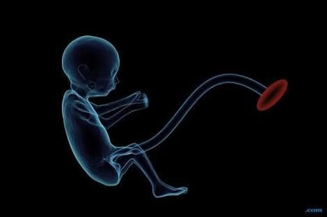 Jasad Janin Bayi Korban Aborsi Ditemukan di Kiaracondong