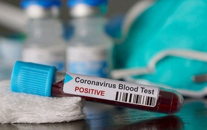 Padalarang Jadi Zona Merah Corona di Bandung Barat