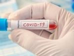 Pengurus NasDem KBB Dites Rapid Antigen, Kontak Erat dengan Bupati yang Positif Covid-19