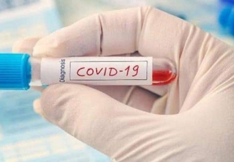 Belum Diberi Nama, Bayi Berusia 1 Hari Positif Corona