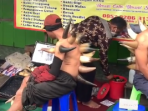 Viral Terapi Bekam Tanduk Api, Pasien Jadi Mirip Godzilla