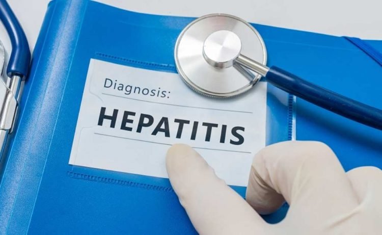 Pemerintah Lakukan Penyelidikan Epidemiologi untuk Antisipasi Hepatitis Misterius