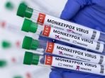 Tak Ada Laporan Warga, Dinkes KBB Tetap Waspadai Penyebaran Monkeypox