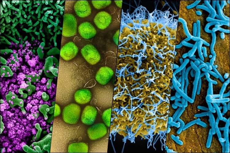 Muncul Banyak Virus, Perubahan Iklim Picu Penyakit Lompat ke Manusia