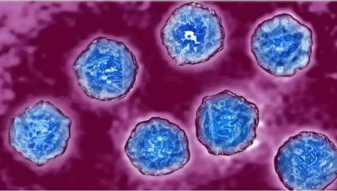 Virus Zombie Bangkit dari Dalam Es, Dikhawatirkan Seperti Covid-19