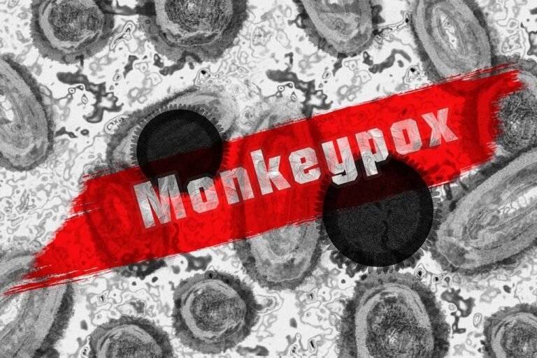 Kasus Cacar Monyet Belum Terdeteksi di Cimahi, Pemkot Minta Masyarakat Tetap Waspada
