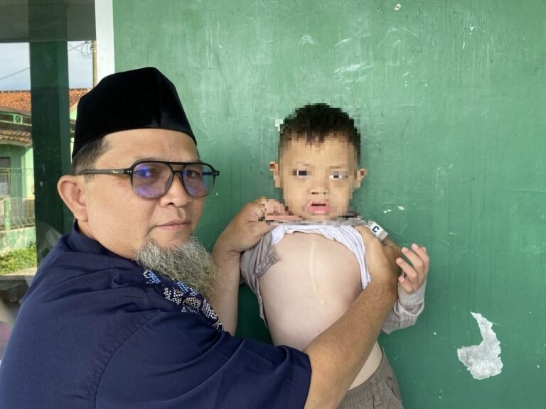 Bukti Nyata Manfaat Program JKN Dalam Membantu Pengobatan Buah Hati Deden